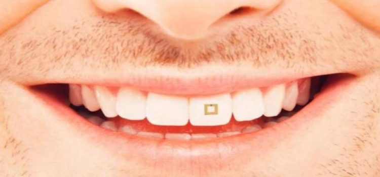 Crean sensor dental que monitorea lo que comes