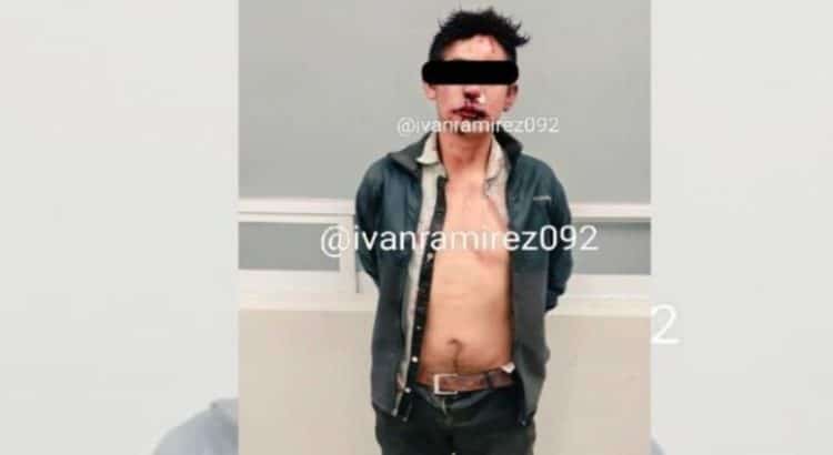 Se escapa hombre que estaba bajo custodia en un hospital